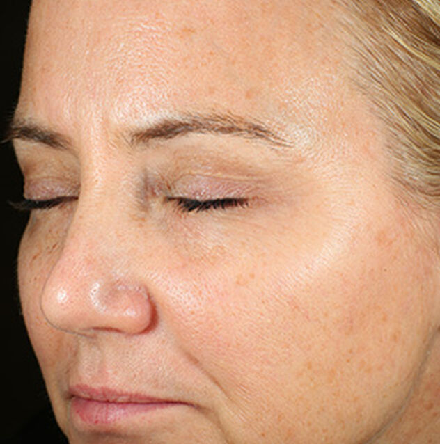Before image