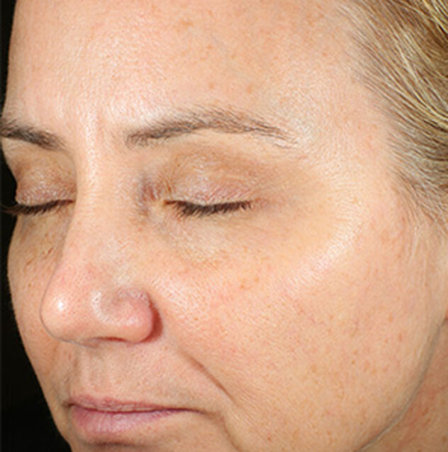 After image